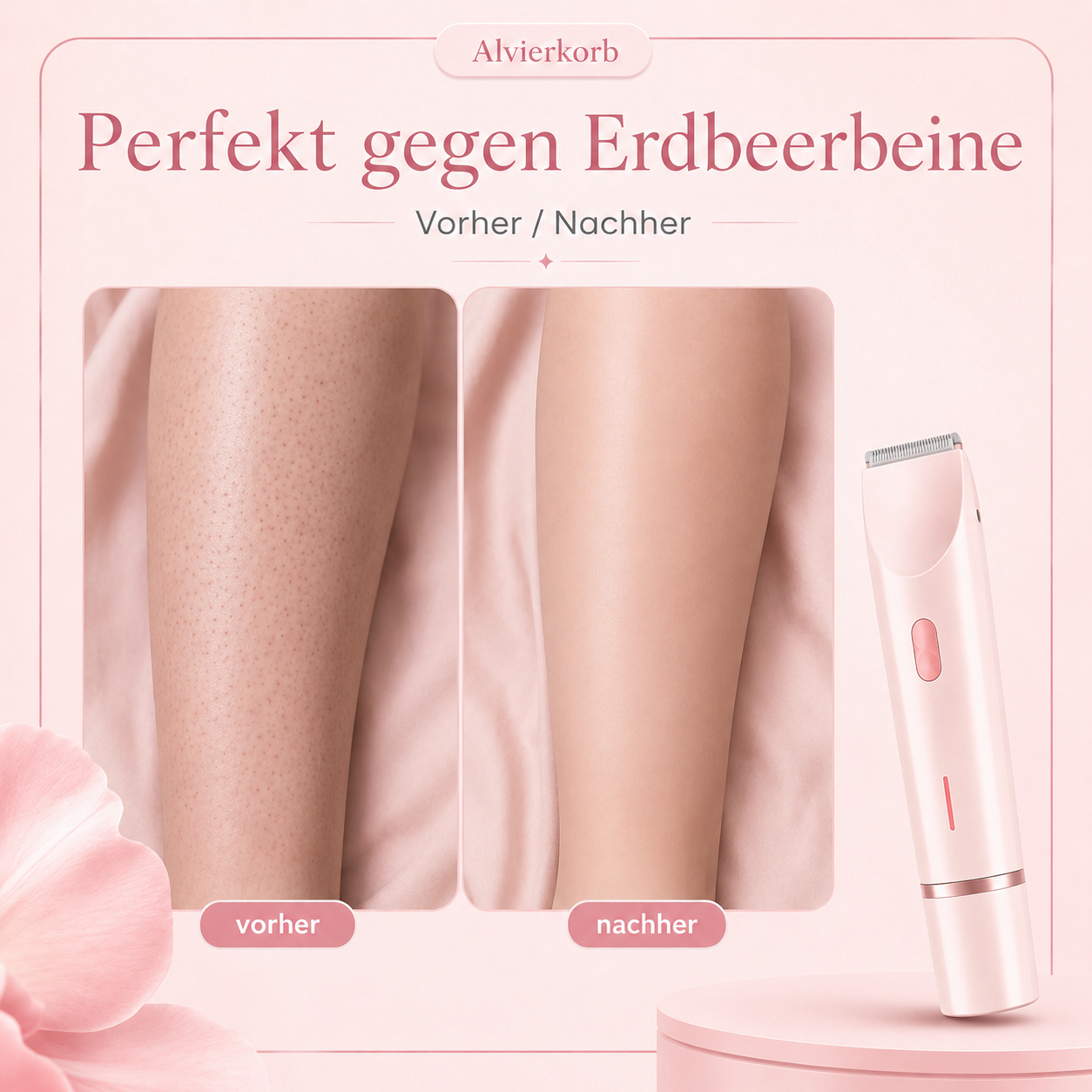 BloomSkin™ – Sanfter 2-in-1 Damenrasierer