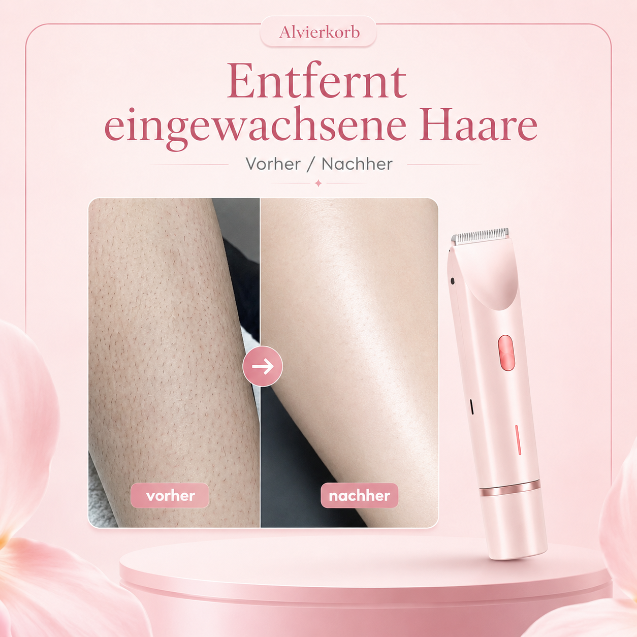 BloomSkin™ – Sanfter 2-in-1 Damenrasierer