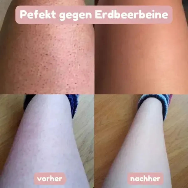 BloomSkin™ – Sanfter 2-in-1 Damenrasierer